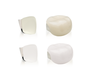 First Primary Molar Refills